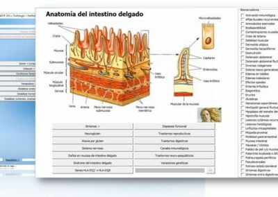 celiaquia